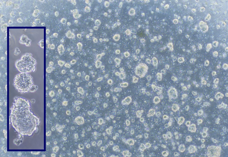 Forsea's organoids at record-breaking cell density.jpg